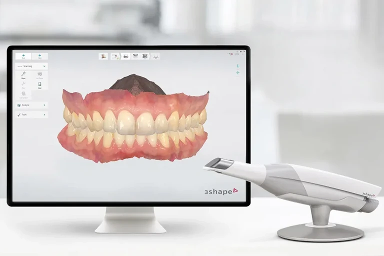 iTero Scanner